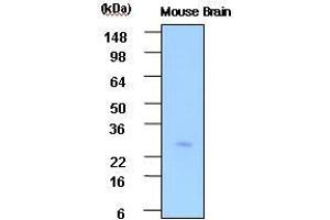The extracts of Mouse brain(30 ug) were resolved by SDS-PAGE, transferred to PVDF membrane and probed with anti-human PSP (1:1,000). (STXBP3 抗体  (AA 1-225))