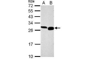 WB Image Sample (30 ug of whole cell lysate) A: NIH-3T3 B: BCL-1 12% SDS PAGE antibody diluted at 1:1000 (GRB2 抗体  (C-Term))