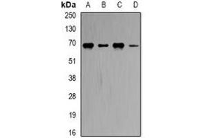 Western blot analysis of CBS expression in Hela (A), MCF7 (B), Romas (C), mouse brain (D) whole cell lysates. (CBS 抗体)