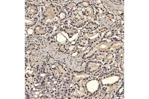 IHC analysis of SNRPA1 using anti-SNRPA1 antibody (ABIN7599131).