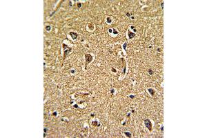 Immunohistochemistry (IHC) image for anti-Calcium Channel, Voltage-Dependent, gamma Subunit 5 (CACNG5) antibody (ABIN3002719) (CACNG5 抗体)