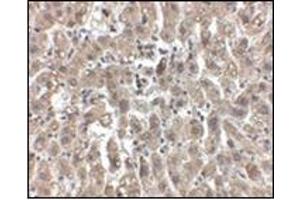 Immunohistochemistry of LDL-R in human liver tissue with this product at 2. (LDLR 抗体  (Center))