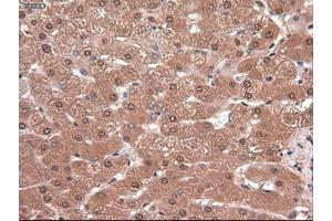 Image no. 4 for anti-Myc Proto-Oncogene protein (MYC) antibody (ABIN1497012) (c-MYC 抗体)