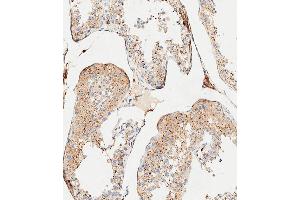 Immunohistochemistry (Paraffin-embedded Sections) (IHC (p)) image for anti-Cathepsin A (CTSA) (AA 18-45), (N-Term) antibody (ABIN654433)