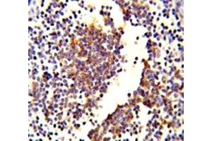 Immunohistochemistry (IHC) image for anti-Complement Component C7 (C7) (AA 375-403) antibody (ABIN3029694)