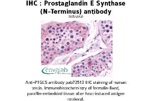 Image no. 1 for anti-Prostaglandin E Synthase (PTGES) (N-Term) antibody (ABIN1738425) (Prostaglandin E Synthase 抗体  (N-Term))