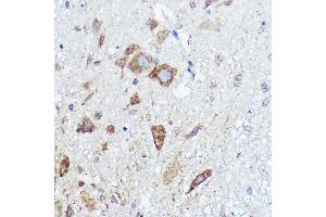 Immunohistochemistry (IHC) image for anti-Abl-Interactor 1 (ABI1) (AA 180-230) antibody (ABIN7265359)