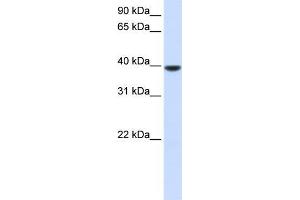 Human Muscle; WB Suggested Anti-AGPAT5 Antibody Titration: 0. (AGPAT5 抗体  (N-Term))