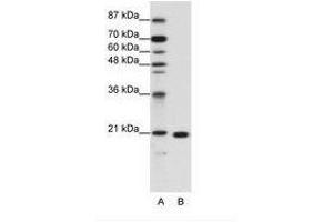 Image no. 1 for anti-Ribosomal Protein L9 (RPL9) (C-Term) antibody (ABIN203024) (RPL9 抗体  (C-Term))