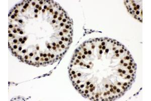 Immunohistochemistry (IHC) image for anti-Ewing Sarcoma Breakpoint Region 1 (EWSR1) (AA 369-399), (Middle Region) antibody (ABIN3043825)
