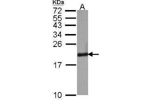 Western Blotting (WB) image for anti-Superoxide Dismutase 1, Soluble (SOD1) antibody (ABIN2854793)