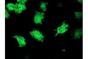 Anti-KATNB1 mouse monoclonal antibody (ABIN2455204) immunofluorescent staining of COS7 cells transiently transfected by pCMV6-ENTRY KATNB1 (RC201852). (KATNB1 抗体)