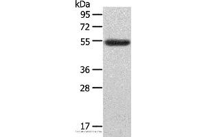 Western blot analysis of Human ovarian cancer tissue, using LAG3 Polyclonal Antibody at dilution of 1:148 (LAG3 抗体)