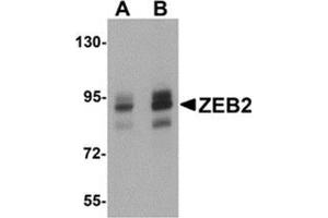 Western blot analysis of ZEB2 in Jurkat cell lysate with ZEB2 antibody at (A) 1 and (B) 2 μg/ml. (ZEB2 抗体  (C-Term))