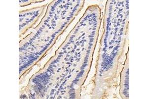 Immunohistochemistry analysis of paraffin-embedded mouse small intestine using ASAH2 (ABIN7074749) at dilution of 1:4200 (ASAH2 抗体)