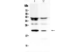 Western blot analysis of IL11 using anti-IL11 antibody . (IL-11 抗体  (AA 25-199))