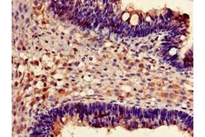 Immunohistochemistry (IHC) image for anti-Fragile X Mental Retardation, Autosomal Homolog 1 (FXR1) (AA 469-614) antibody (ABIN7153147)