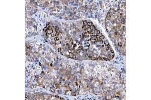IHC analysis of Rab4/RAB4A using anti-Rab4/RAB4A antibody (ABIN7599733).