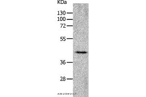 Western blot analysis of Mouse heart tissue, using CHRFAM7A Polyclonal Antibody at dilution of 1:700 (CHRNA7 抗体)