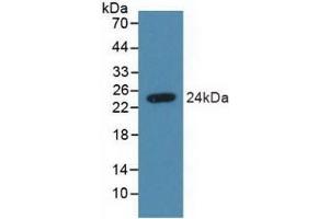 Detection of Recombinant SDC4, Human using Polyclonal Antibody to Syndecan 4 (SDC4) (SDC4 抗体  (AA 18-145))