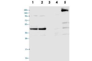Western blot analysis of Lane 1: RT-4, Lane 2: U-251 MG, Lane 3: Human Plasma, Lane 4: Liver, Lane 5: Tonsil with CCDC94 polyclonal antibody  at 1:100-1:250 dilution. (CCDC94 抗体)