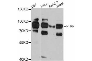 Western blot analysis of extracts of various cell lines, using PFKP antibody. (PFKP 抗体)