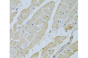 Immunohistochemistry of paraffin-embedded Rat heart using CA3 Polyclonal Antibody at dilution of 1:200 (40x lens). (CA3 抗体)