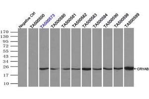 Image no. 2 for anti-Crystallin, alpha B (CRYAB) antibody (ABIN1497645) (CRYAB 抗体)