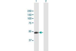 Western Blot analysis of CTSA expression in transfected 293T cell line by CTSA MaxPab polyclonal antibody. (CTSA 抗体  (AA 1-480))