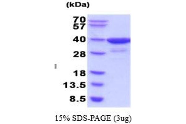 AKR1C4 Protein (AA 1-323)