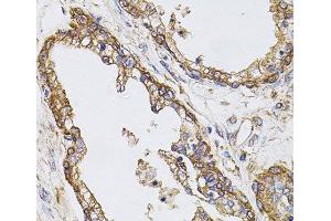 Immunohistochemistry of paraffin-embedded Human prostate using CAST Polyclonal Antibody at dilution of 1:100 (40x lens). (Calpastatin 抗体)