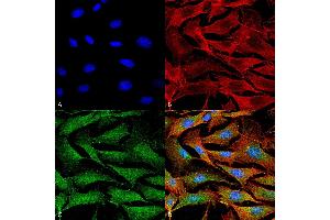 Immunocytochemistry/Immunofluorescence analysis using Mouse Anti-Copper Transporting ATPase 1 Monoclonal Antibody, Clone S60-4 .