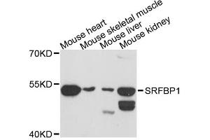 Western blot analysis of extracts of various cell lines, using SRFBP1 antibody. (SRFBP1 抗体)