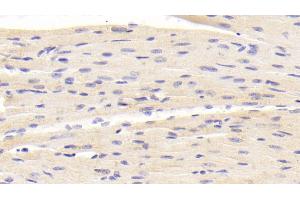 Immunohistochemistry (IHC) image for anti-beta-Site APP-Cleaving Enzyme 2 (BACE2) (AA 230-396) antibody (ABIN7434101)