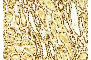Immunohistochemistry (IHC) image for anti-V-Erb-A erythroblastic Leukemia Viral Oncogene Homolog 4 (Avian) (ERBB4) (pTyr1284) antibody (ABIN6256632)