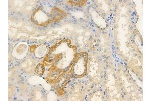 ABIN6263172 and ABIN6272342 at 1/100 staining human normal kidney tissue by IHC-P.