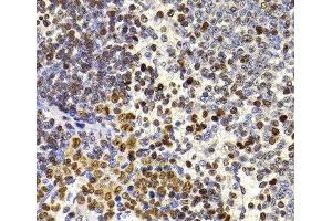 Immunohistochemistry of paraffin-embedded Rat spleen using HIRIP3 Polyclonal Antibody at dilution of 1:100 (40x lens). (HIRIP3 抗体)
