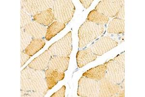 Immunohistochemistry of paraffin embedded rat skeletal muscle using ATP2A2 (ABIN7075545) at dilution of 1: 500 (400x lens) (SERCA2 ATPase 抗体)