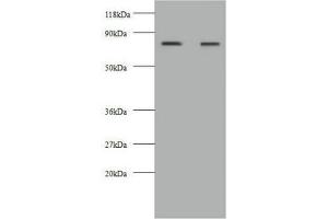 Western blot All lanes: KNG1 antibody at 2 μg/mL Lane 1: HepG2 whole cell lysate Lane 2: 293T whole cell lysate Secondary Goat polyclonal to rabbit IgG at 1/10000 dilution Predicted band size: 72, 48, 44 kDa Observed band size: 72 kDa (KNG1 抗体  (AA 390-644))