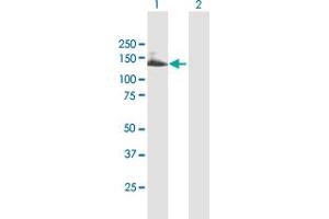 Western Blot analysis of TTC18 expression in transfected 293T cell line by TTC18 MaxPab polyclonal antibody. (TTC18 抗体  (AA 1-1121))
