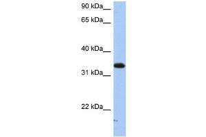WB Suggested Anti-SULT6B1 Antibody Titration:  0. (SULT6B1 抗体  (C-Term))