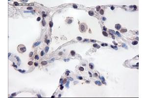 Immunohistochemical staining of paraffin-embedded lung using anti-PECAM1 (TA000121) mouse monoclonal antibody. (CD31 抗体  (AA 425-591))