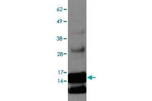 Western blot on ENHO overexpression lysate with ENHO polyclonal antibody . (ENHO 抗体  (AA 10-60))