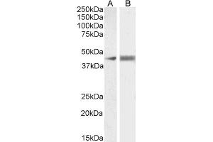 Western Blotting (WB) image for anti-Actin, alpha 2, Smooth Muscle, Aorta (ACTA2) (N-Term) antibody (ABIN185271)