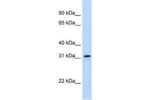 Western Blotting (WB) image for anti-MKI67 FHA Domain-Interacting Nucleolar Phosphoprotein (MKI67IP) antibody (ABIN2462317) (NIFK 抗体)