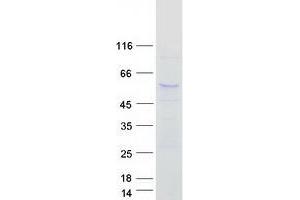 Western Blotting (WB) image for Abhydrolase Domain Containing 8 (ABHD8) protein (Myc-DYKDDDDK Tag) (ABIN2714280)