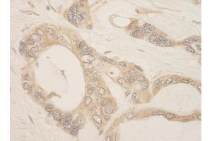 anti-Cancer Susceptibility Candidate 3 (CASC3) (AA 225-275) antibody