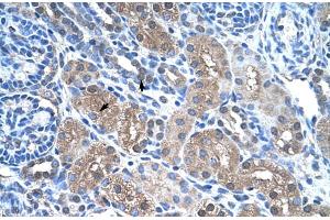 Rabbit Anti-FBP1 Antibody  Paraffin Embedded Tissue: Human Kidney Cellular Data: Epithelial cells of renal tubule Antibody Concentration: 4.
