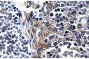Immunohistochemistry (IHC) analyzes of VASP antibody in paraffin-embedded human tonsil tissue. (VASP 抗体  (pSer157))