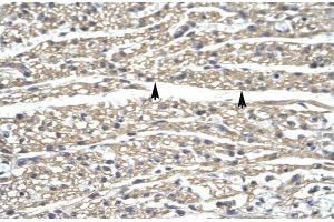Human Heart; ZNF336 antibody - N-terminal region in Human Heart cells using Immunohistochemistry (ZNF336 抗体  (N-Term))